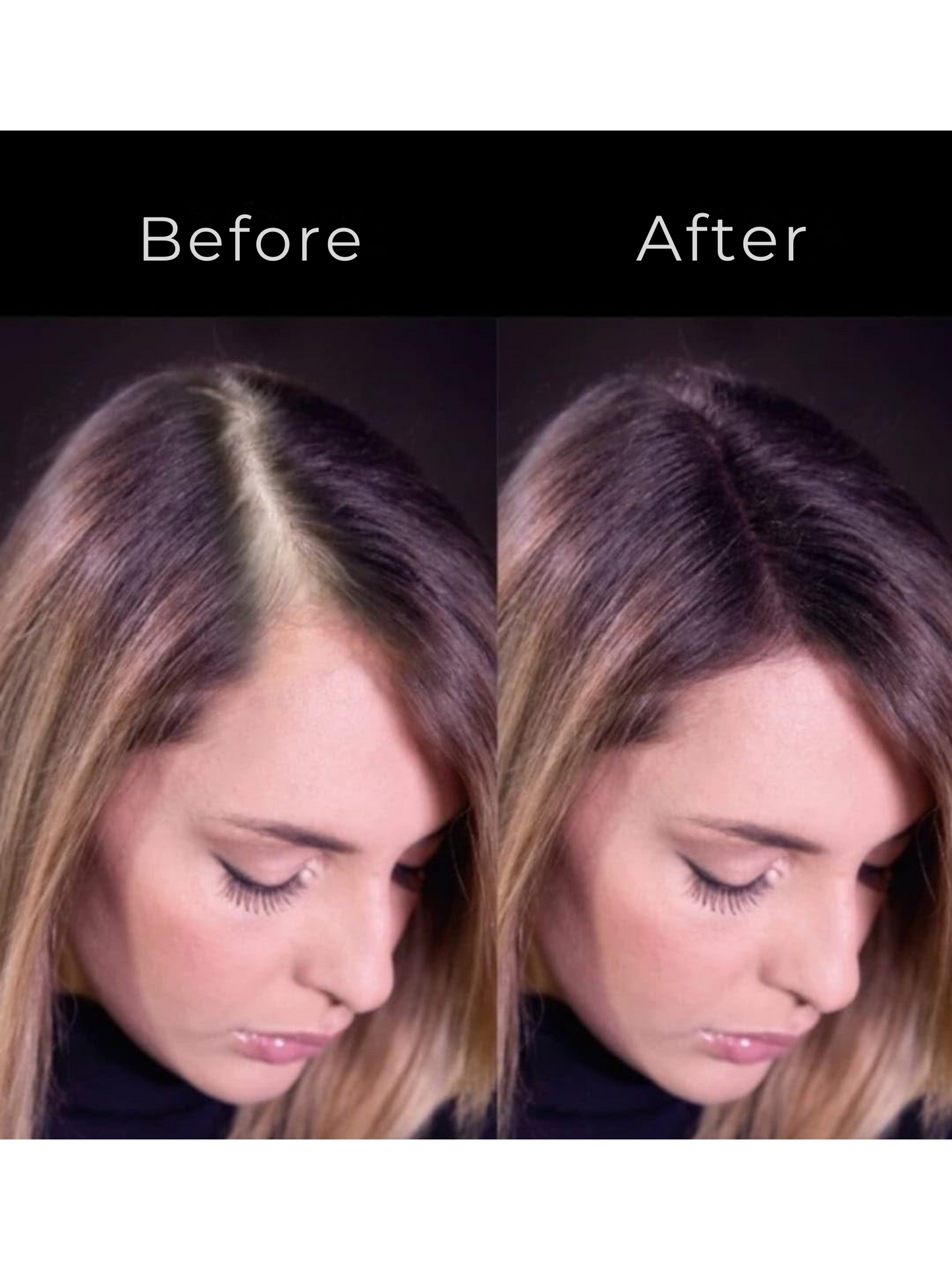 Calvena™ Thickener Hair Fibers For Men & Women