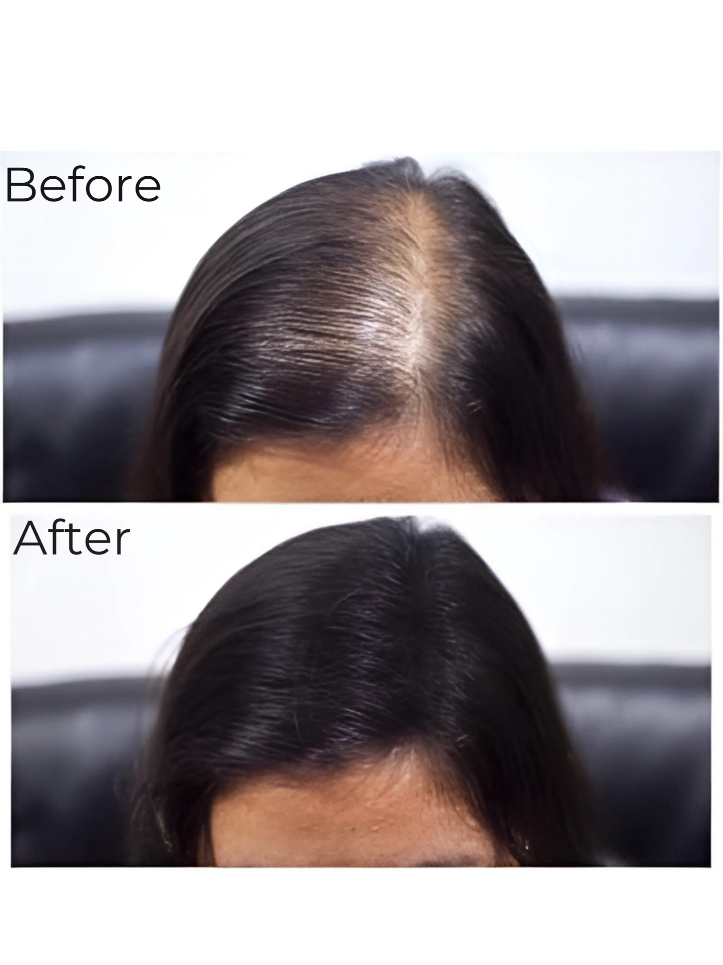 Calvena™ Thickener Hair Fibers For Men & Women