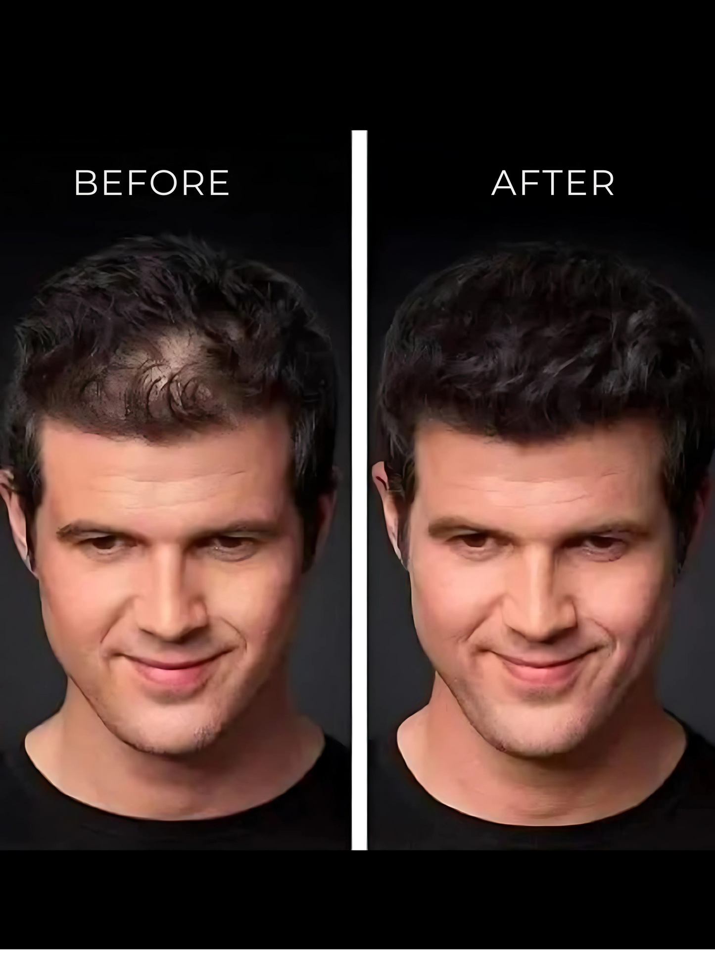 Calvena™ Thickener Hair Fibers For Men & Women