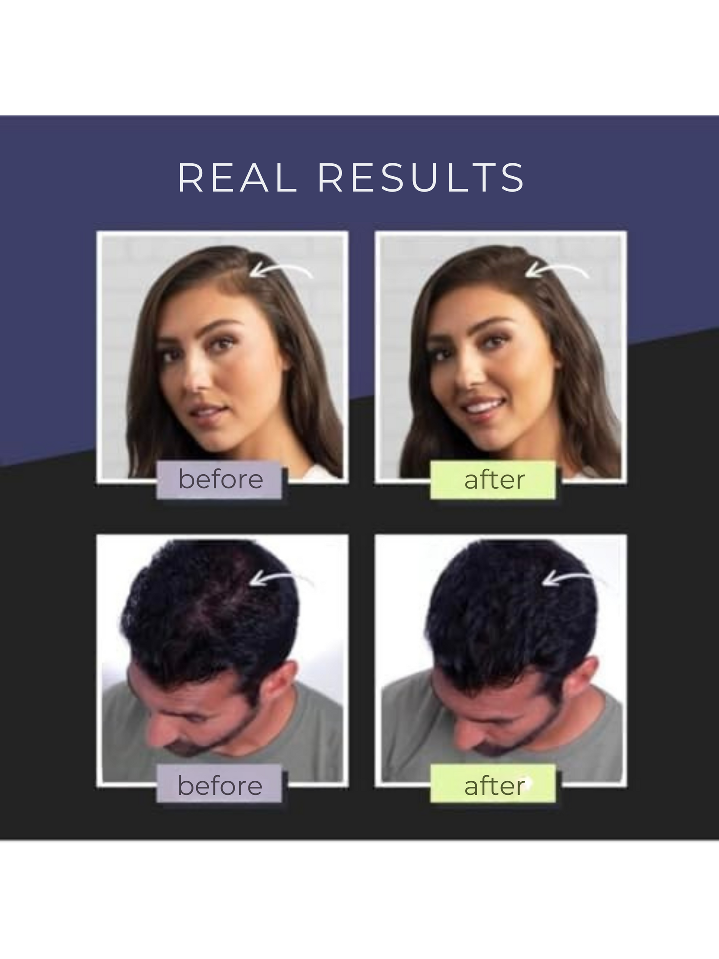 Calvena™ Thickener Hair Fibers For Men & Women